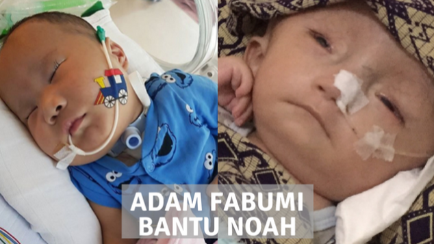 Adam Fabumi Bantu Noah Sehat