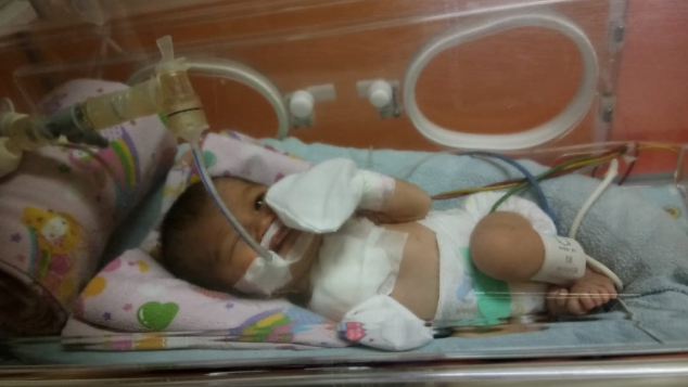 Bantu bayi Banafsha bertahan melawan Asfiksia