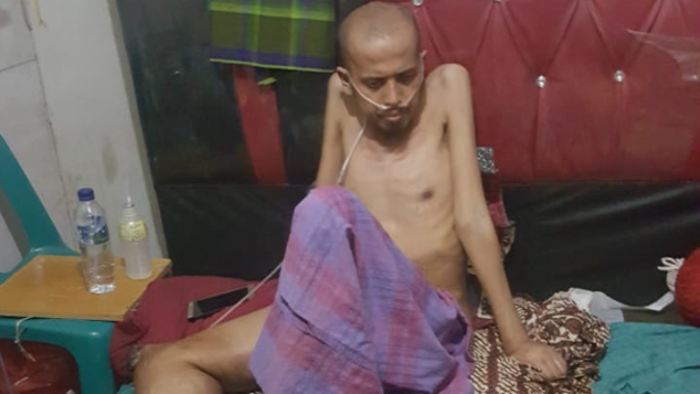 Bantulah anak yatim dari ganas fibrosarcoma