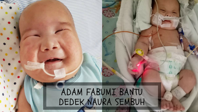 Adam Fabumi Bantu Dedek Naura Sembuh
