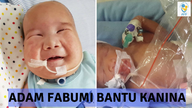 Adam Fabumi Bantu Kanina Sembuh