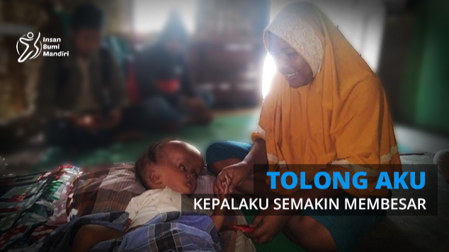 KEPALAKU MEMBESAR SETIAP HARINYA