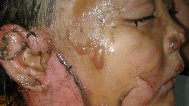 BANTU VIRA SEMBUH