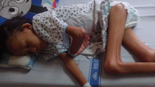 Bantu Fabia melawan Kolostomi dan gizi buruk