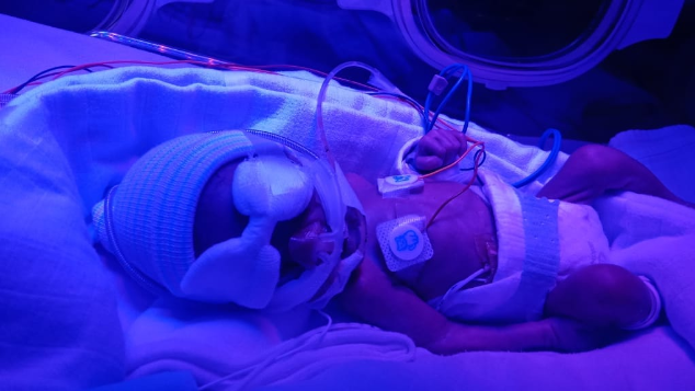 Bantu Adek Naura Berjuang di Ruang NICU
