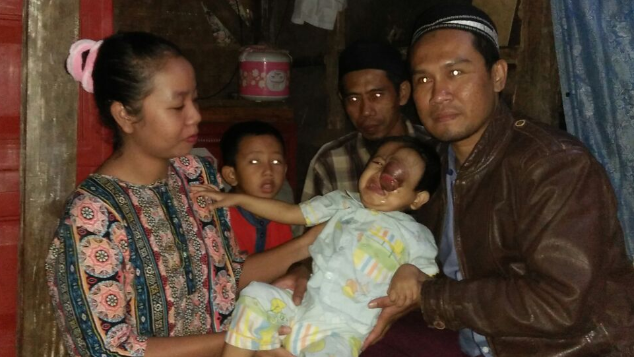 Bantu M. Malik Maulana Sembuh dari Kanker Mata