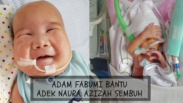Adam Fabumi Bantu Adek Naura Azizah Sembuh