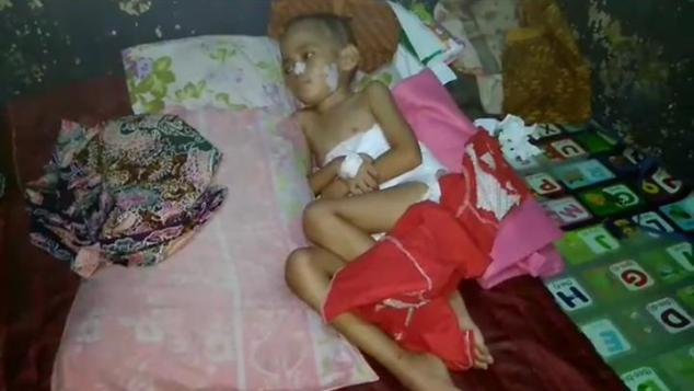 Bantu Mahardika Melawan Tumor Ganas di Otak