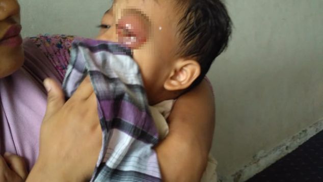 Bantu Rizky sembuh dari tumor