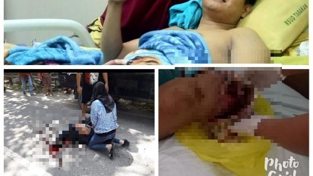 Bantu Rano dari kakinya yang putus