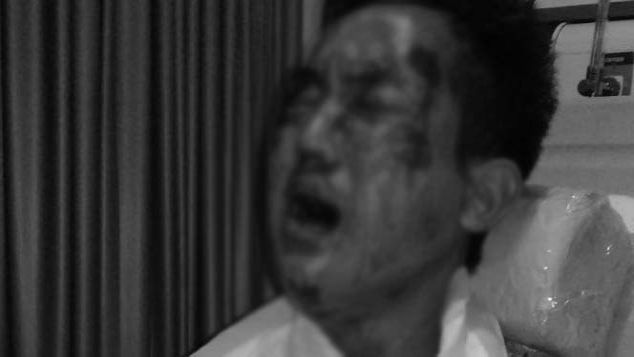 bantu yanuar untuk kembali pulih