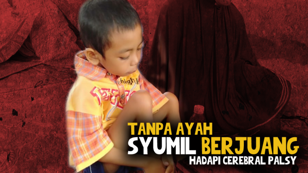 Alami Kelumpuhan Otak, Syumil Tak Bisa Berjalan