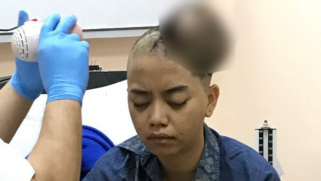 Bantu Dhea Untuk Sembuh Dari Penyakit Tumor Ganas