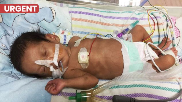 Gibran sang pejuang NICU sembuh