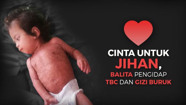 Jihan, Balita Pengidap TB dalam Kondisi Gizi Buruk