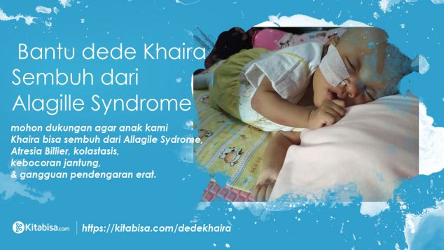 Bantu dede Khaira Sembuh dari Alagille Syndrome
