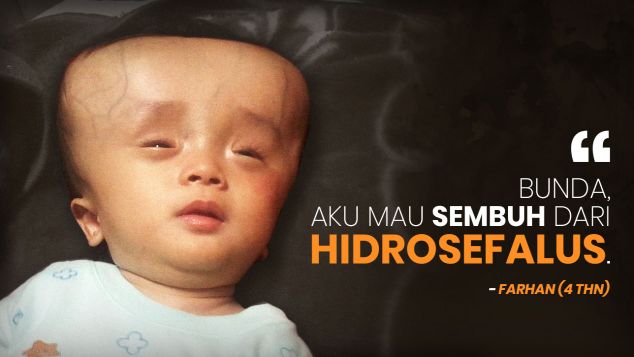 Bantu Farhan (4 thn) Sembuh dari Hidrosefalus