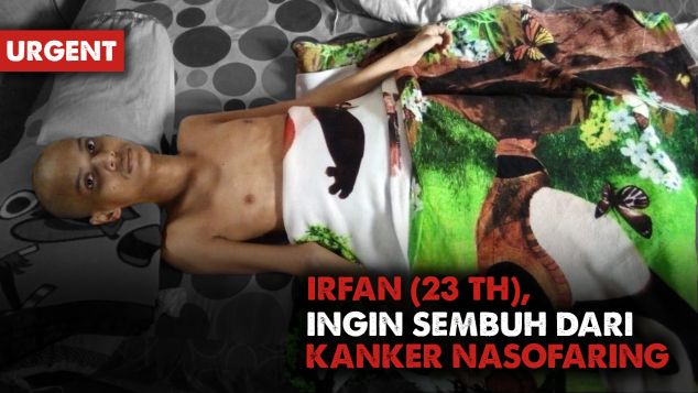 Bantu Perjuangan Irfan Melawan Kanker Nasofaring