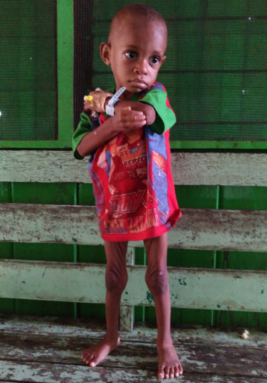 Kitabisa! - Ultah #LumiZayka Untuk Pejuang Gizi Buruk