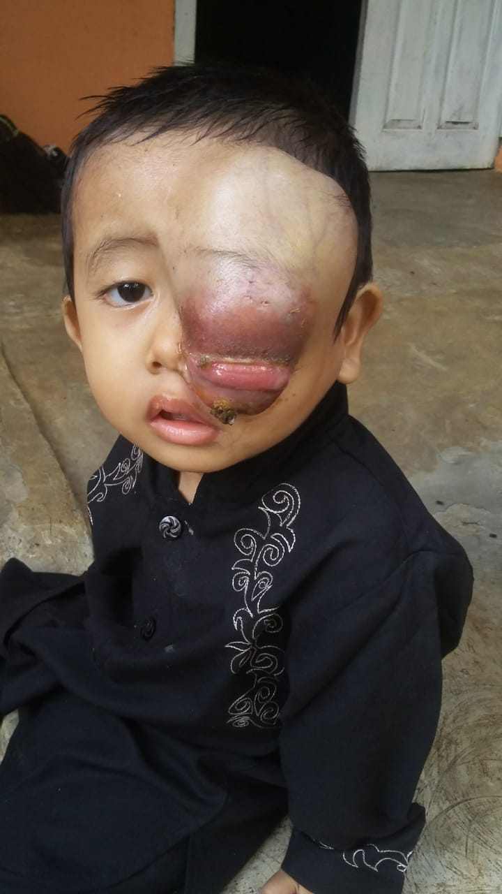 Kondisi Malik 2