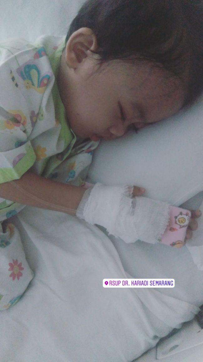 28 OPERASI TUMOR OTAK BPJS